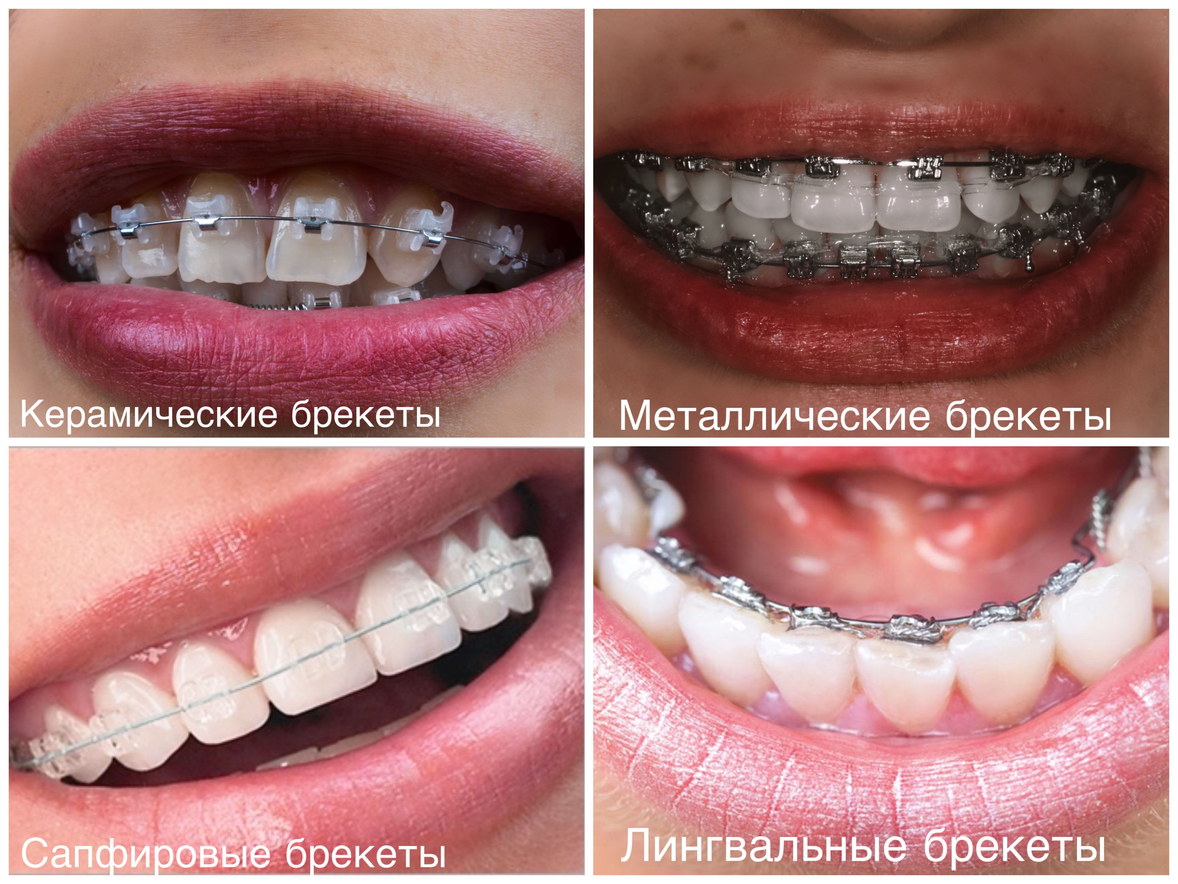 Ортодонтия 6 Ортодонтия 6